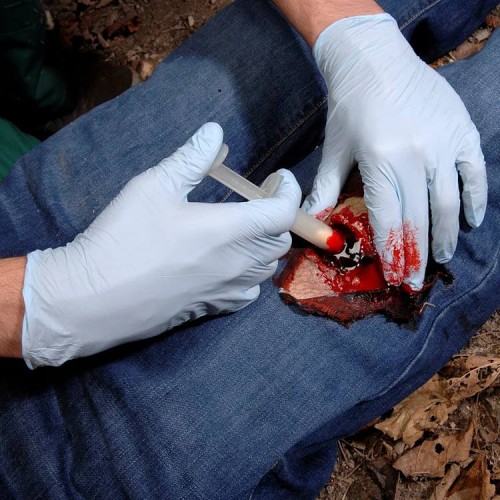 Аппликатор гемостатический с гранулами Rhino Rescue в Туле хитозановый
